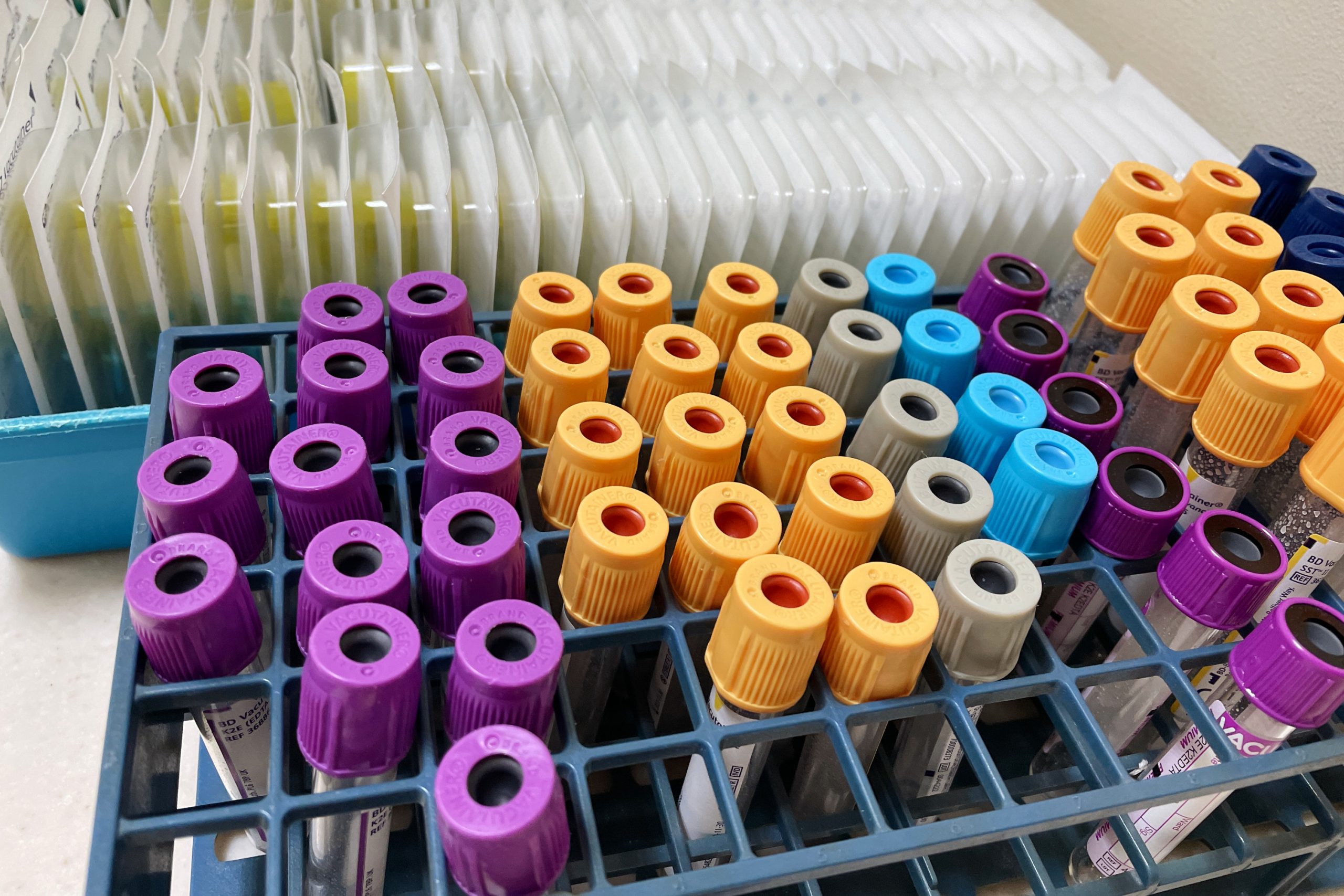 blood-samples-in-laboratory